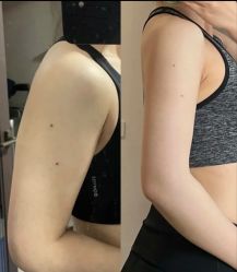 -Lily纤美·科技减脂中心