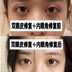 -上海漾颜医疗美容