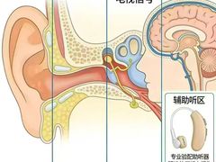 -自然之声助听器·呼吸机(康桥旗舰店)