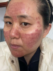 -空军总医院激光整形美容中心