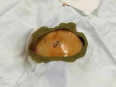 -中南大学湘雅医院
