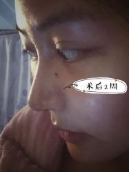 -素美医疗美容·西南眼鼻整形·修复基地