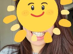 -上海仁爱医院口腔科 · 种植