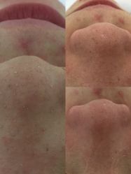 点击看大图 -skin79皮肤管理中心