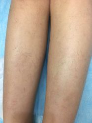 -北京米扬丽格医疗美容·联合丽格鼻整形中心