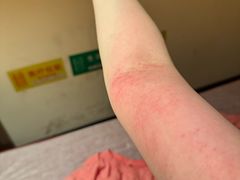 -沐善人家中医·推拿·理疗·三伏灸(新洲店)