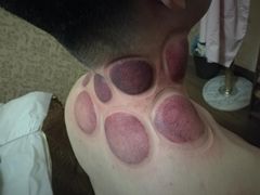 -御筋堂正骨推拿(星源国际店)