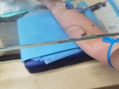 -杭州市第一人民医院(湖滨院区)