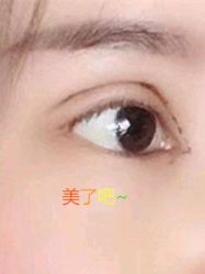 -美莱医学美容医院