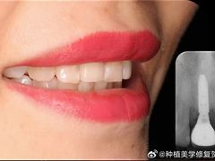 -永信齿科·永恩口腔门诊部(浦东新区店)