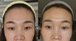 -上海漾颜医疗美容