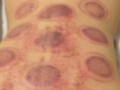 -1号足道推拿会馆