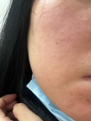 体验后-八大处整形