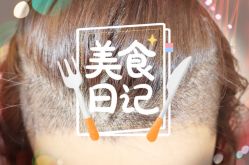 -大麦微针植发全国连锁