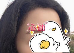 -大麦微针植发全国连锁