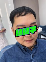 -大麦微针植发全国连锁