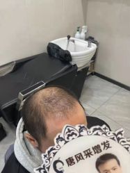 -唐风采假发补发定制