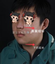 -北京米扬丽格医疗美容·联合丽格鼻整形中心