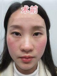 -素美医疗美容·西南眼鼻整形·修复基地