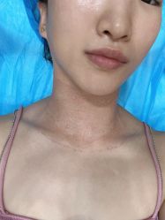 体验后-美瑞莎创美医疗美容