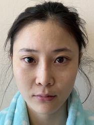 -北京米扬丽格医疗美容·联合丽格鼻整形中心