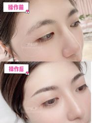 点击看大图 -UP&UP·半永久眉毛眼线机器野生眉