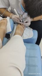 -派恩宜灰指甲鸡眼嵌甲手足癣