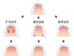 -团圆口腔·种植中心(锦江院区)