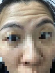 -小忠丽格医美