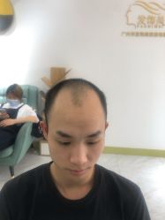 -发饰美男士增发补发假发定制店