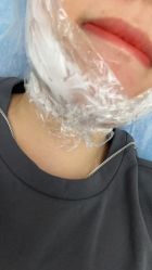 -小忠丽格医美
