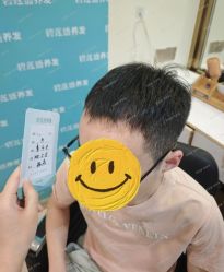 -碧莲盛·不剃发植发