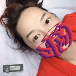 点击看大图 -郡艺医疗美容·微整·眼鼻吸脂