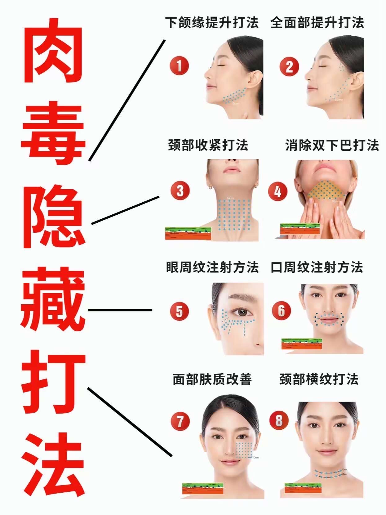 口周纹肉毒素注射方法图片