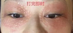 体验后-深圳广和门诊部·整形医疗美容