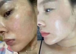 体验前-伊美康医疗美容·抗衰中心