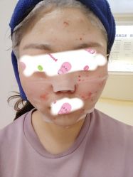 体验后-河南中医药大学第一附属医院-医疗整形