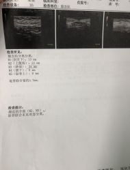 -伊丽莎白医疗美容