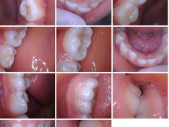 -极橙儿童齿科矫正中心(奥城店)