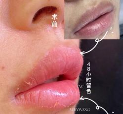 -Verywang半永久纹眉•仪器野生眉