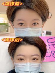 -UP&UP·半永久眉毛眼线机器野生眉