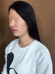 体验前-西美医疗美容门诊部