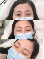 -久匠半永久纹眉