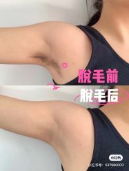 -中科妍美专业脱毛美肤连锁机构