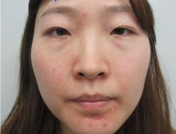 -素美医疗美容·西南眼鼻整形·修复基地