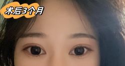 -素美医疗美容·西南眼鼻整形·修复基地