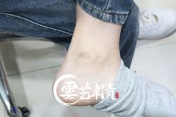 -雲艺刺青·洗纹身