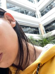 体验后-成都西区医院整形美容