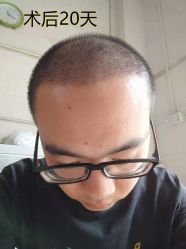 -雍禾植发全国连锁