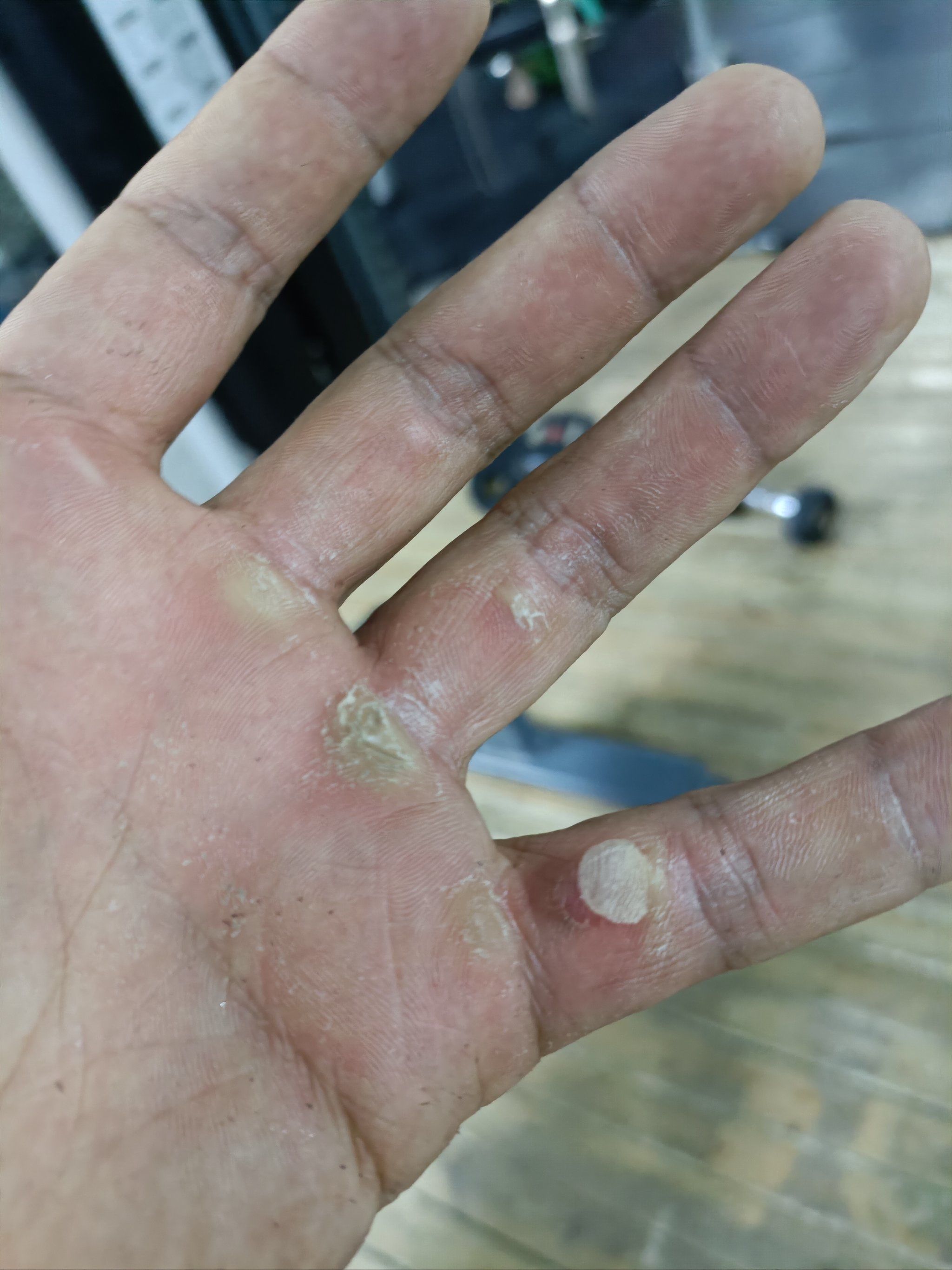 每年都要破一次茧